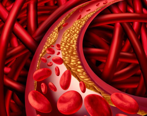 รู้ทันยา WARFARIN (วอร์ฟาริน)