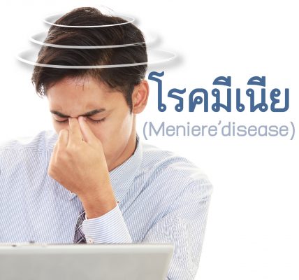 โรคมีเนีย (Meniere’s disease)